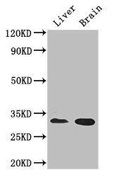 CD37 Antibody - Positive WB detected in:Mouse liver tissue,Mouse brain tissue;All lanes: CD37 antibody at 2.7ug/ml;Secondary;Goat polyclonal to rabbit IgG at 1/50000 dilution;Predicted band size: 32,24,23 kDa;Observed band size: 32 kDa;