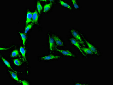 CD37 Antibody - Immunofluorescent analysis of Hela cells using CD37 Antibody at dilution of 1:100 and Alexa Fluor 488-congugated AffiniPure Goat Anti-Rabbit IgG(H+L)