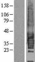 CD37 Protein - Western validation with an anti-DDK antibody * L: Control HEK293 lysate R: Over-expression lysate