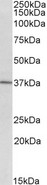 CD38 Antibody - CD38 antibody (2 ug/ml) staining of Human Spinal Cord cancer lysate (35 ug protein in RIPA buffer). Primary incubation was 1 hour. Detected by chemiluminescence.