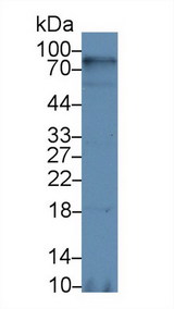 CD38 Antibody - Western Blot; Sample: Human Hela cell lysate; Primary Ab: 5µg/ml Rabbit Anti-Rat cADPRH Antibody Second Ab: 0.2µg/mL HRP-Linked Caprine Anti-Rabbit IgG Polyclonal Antibody