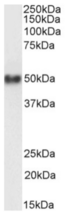 CD38 Antibody - IF staining of Daudi cells.
