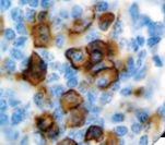 CD38 Antibody - IHC of CD38 on FFPE Tonsil tissue. This image was taken for the unmodified form of this product. Other forms have not been tested.