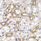 CD38 Antibody - Immunohistochemistry of paraffin-embedded rat kidney tissue.