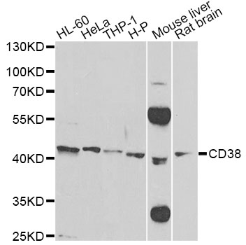 CD38 Antibody - Western blot analysis of extracts of various cell lines, using CD38 antibody at 1:500 dilution. The secondary antibody used was an HRP Goat Anti-Rabbit IgG (H+L) at 1:10000 dilution. Lysates were loaded 25ug per lane and 3% nonfat dry milk in TBST was used for blocking. An ECL Kit was used for detection and the exposure time was 90s.