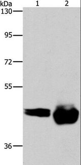 CD38 Antibody - Western blot analysis of A549 and Raji cell, using CD38 Polyclonal Antibody at dilution of 1:520.