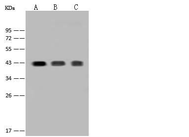 CD38 Antibody - Anti-CD38 rabbit polyclonal antibody at 1:500 dilution. Lane A: Jurkat Whole Cell Lysate. Lane B: THP-1 Whole Cell Lysate. Lane C: HuT-78 Whole Cell Lysate. Lysates/proteins at 30 ug per lane. Secondary: Goat Anti-Rabbit IgG (H+L)/HRP at 1/10000 dilution. Developed using the ECL technique. Performed under reducing conditions. Predicted band size: 34 kDa. Observed band size: 43 kDa.