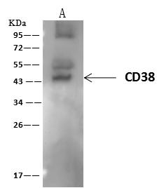 CD38 Antibody - CD38 was immunoprecipitated using: Lane A: 0.5 mg Jurkat Whole Cell Lysate. 4 uL anti-CD38 rabbit polyclonal antibody and 60 ug of Immunomagnetic beads Protein A/G. Primary antibody: Anti-CD38 rabbit polyclonal antibody, at 1:100 dilution. Secondary antibody: Goat Anti-Rabbit IgG (H+L)/HRP at 1/10000 dilution. Developed using the ECL technique. Performed under reducing conditions. Predicted band size: 34 kDa. Observed band size: 43 kDa.