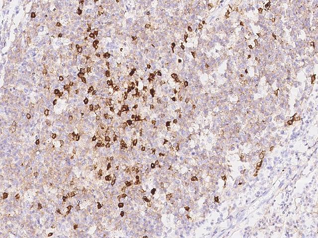 CD38 Antibody - Immunochemical staining of human CD38 in human tonsil with rabbit polyclonal antibody at 1:1000 dilution, formalin-fixed paraffin embedded sections.