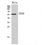 CD39 Antibody - Western blot of CD39 antibody