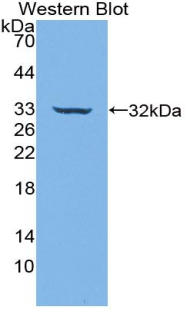 CD39 Antibody - Western blot of recombinant CD39.