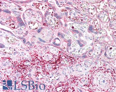 CD39 Antibody - Human Placenta: Formalin-Fixed, Paraffin-Embedded (FFPE)