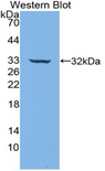 CD39 Antibody - Western blot of recombinant CD39.