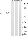 CD39 Antibody - Western blot analysis of lysates from HeLa and Jurkat cells, using ENTPD1 Antibody. The lane on the right is blocked with the synthesized peptide.