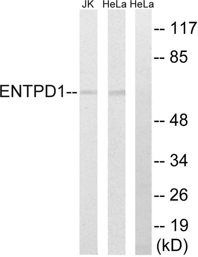CD39 Antibody - Western blot analysis of lysates from HeLa and Jurkat cells, using ENTPD1 Antibody. The lane on the right is blocked with the synthesized peptide.