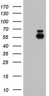 CD39 Antibody - HEK293T cells were transfected with the pCMV6-ENTRY control (Left lane) or pCMV6-ENTRY ENTPD1 (Right lane) cDNA for 48 hrs and lysed. Equivalent amounts of cell lysates (5 ug per lane) were separated by SDS-PAGE and immunoblotted with anti-ENTPD1.