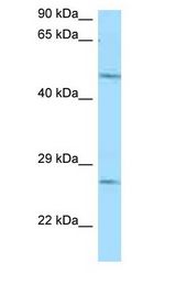 CD39 Antibody - CD39 antibody Western Blot of Mouse Heart.  This image was taken for the unconjugated form of this product. Other forms have not been tested.