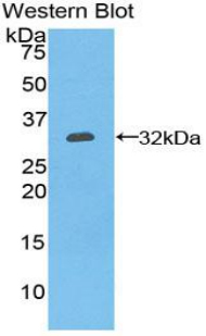 CD39 Antibody - Western blot of recombinant CD39.  This image was taken for the unconjugated form of this product. Other forms have not been tested.