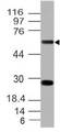 CD39 Antibody - Fig-1: Western blot analysis of hCD39. Anti-hCD39 antibody was used at 2 µg/ml on mouse placenta lysate.