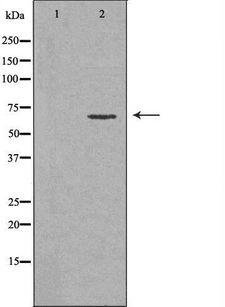 CD39 Antibody - Western blot analysis of extracts of HeLa cells using ENTPD1 antibody.