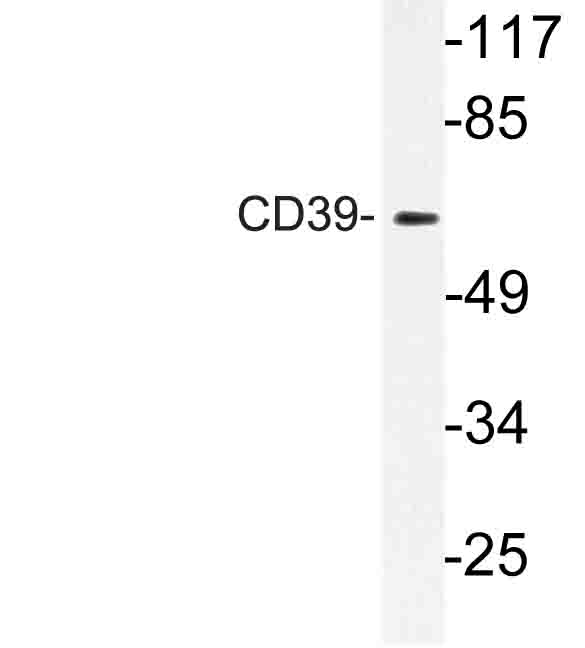 CD39 Antibody - Western blot of CD39 (K388) pAb in extracts from Jurkat cells.