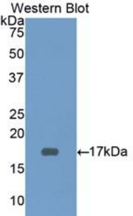 CD3D Antibody - Western blot of recombinant CD3D.  This image was taken for the unconjugated form of this product. Other forms have not been tested.