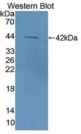 CD3D Antibody - Western blot of CD3D antibody.