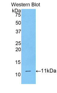 CD3D Antibody - Western blot of recombinant CD3D.  This image was taken for the unconjugated form of this product. Other forms have not been tested.