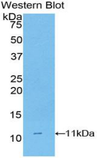 CD3D Antibody - Western blot of recombinant CD3D.  This image was taken for the unconjugated form of this product. Other forms have not been tested.