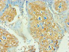 CD3D Antibody - Immunohistochemistry of paraffin-embedded human tonsil using antibody at 1:100 dilution.