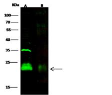 CD3D Antibody - Anti-CD3D mouse monoclonal antibody at 1:500 dilution. Lane A: Jurkat Whole Cell Lysate. Lane B: Molt-4 Whole Cell Lysate. Lysates/proteins at 30 ug per lane. Secondary: Goat Anti-Mouse IgG H&L (Dylight800) at 1/15000 dilution. Developed using the Odyssey technique. Performed under reducing conditions. Predicted band size: 19 kDa. Observed band size: 24 kDa.