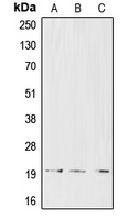 CD3D Antibody - Western blot analysis of CD3d expression in CCRFCEM (A); Jurkat (B); HuT78 (C) whole cell lysates.