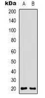 CD3D Antibody - Western blot analysis of CD3d expression in Jurkat (A); HeLa (B) whole cell lysates.