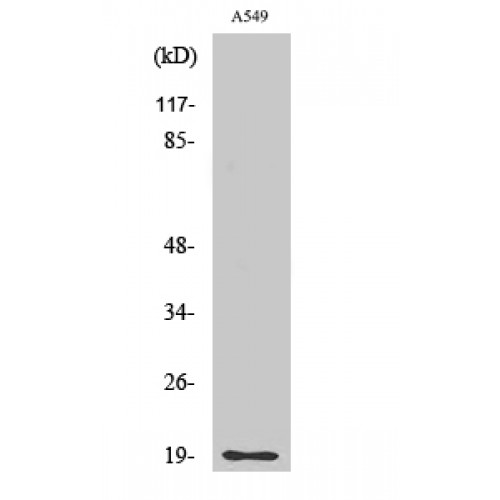 CD3D Antibody - Western blot of CD3-delta antibody