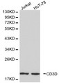 CD3D Antibody - Western blot of CD3D pAb in extracts from Jurkat and HuT-78 cells.