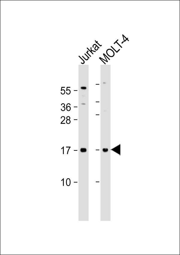 CD3D Antibody - All lanes: Anti-CD3d Antibody at 1:500 dilution. Lane 1: Jurkat whole cell lysate. Lane 2: MOLT-4 whole cell lysate Lysates/proteins at 20 ug per lane. Secondary Goat Anti-Rabbit IgG, (H+L), Peroxidase conjugated at 1:10000 dilution. Predicted band size: 19 kDa. Blocking/Dilution buffer: 5% NFDM/TBST.