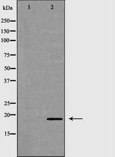 CD3D Antibody - Western blot analysis of Jurkat cells using CD3D antibody. The lane on the left is treated with the antigen-specific peptide.