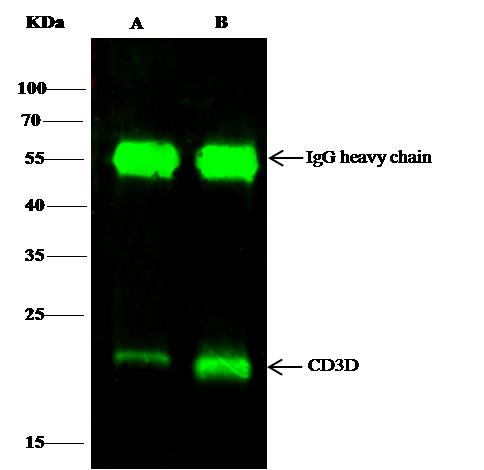 CD3D Antibody - CD3D was immunoprecipitated using: Lane A: 0.5 mg Jurkat Whole Cell Lysate. Lane B: 0.5 mg HuT78 Whole Cell Lysate. 0.5 uL anti-CD3D rabbit polyclonal antibody and 15 ul of 50% Protein G agarose. Primary antibody: Anti-CD3D rabbit polyclonal antibody, at 1:1000 dilution. Secondary antibody: Dylight 800-labeled antibody to rabbit IgG (H+L), at 1:5000 dilution. Developed using the odssey technique. Performed under reducing conditions. Predicted band size: 20 kDa. Observed band size: 20 kDa.
