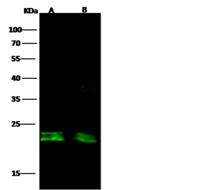 CD3D Antibody - Anti-CD3D rabbit polyclonal antibody at 1:500 dilution. Lane A: Jurkat Whole Cell Lysate. Lane B: Hu-T78 Whole Cell Lysate. Lysates/proteins at 20 ug per lane. Secondary: Goat Anti-Rabbit IgG H&L (Dylight800) at 1/10000 dilution. Developed using the Odyssey technique. Performed under reducing conditions. Predicted band size: 19 kDa. Observed band size: 21 kDa.