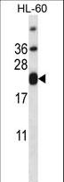 CD3E Antibody - CD3E Antibody western blot of HL-60 cell line lysates (35 ug/lane). The CD3E antibody detected the CD3E protein (arrow).