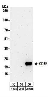 CD3E Antibody - Detection of Human CD3E by Western Blot. Samples: Whole cell lysate (50 ug) from HeLa, 293T, and Jurkat cells. Antibodies: Affinity purified rabbit anti-CD3E antibody used for WB at 0.1 ug/ml. Detection: Chemiluminescence with an exposure time of 3 minutes.