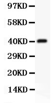 CD3E Antibody - CD3 epsilon antibody Western blot. All lanes: Anti CD3 Epsilon at 0.5 ug/ml. WB : Recombinant Human CD3epsilon Protein 0.5ng . Predicted band size: 40 kD. Observed band size: 40 kD.