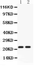 CD3E Antibody - CD3 epsilon antibody Western blot. All lanes: Anti CD3 Epsilon at 0.5 ug/ml. Lane 1: JURKAT Whole Cell Lysate at 40 ug. Lane 2: CEM Whole Cell Lysate at 40 ug. Predicted band size: 23 kD. Observed band size: 23 kD.