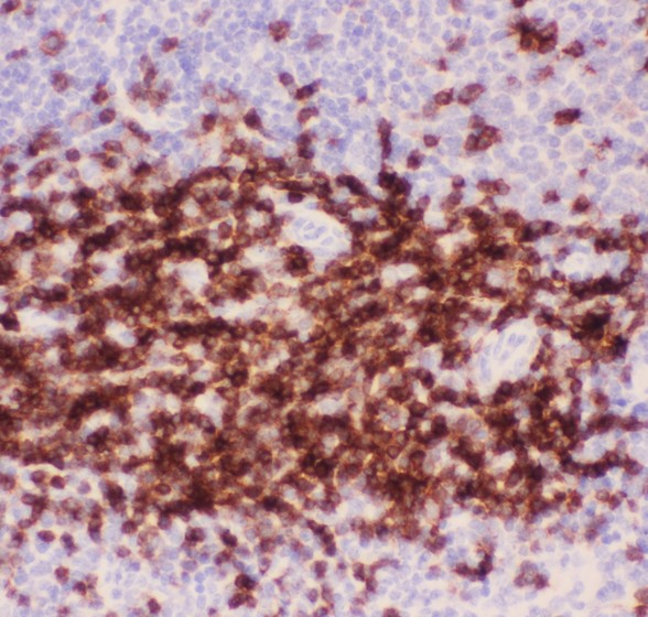 CD3E Antibody - CD3 epsilon antibody IHC-paraffin: Mouse Spleen Tissue.