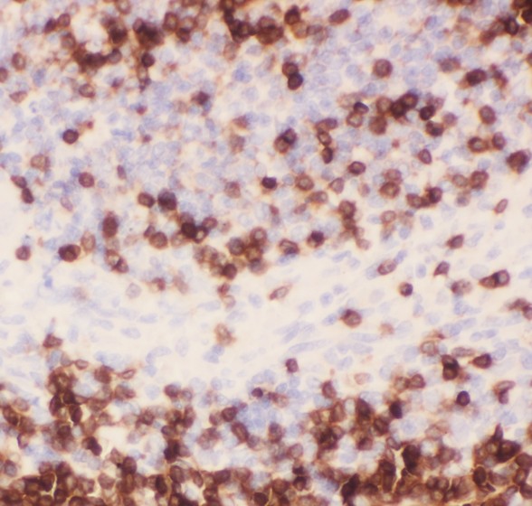 CD3E Antibody - CD3 epsilon antibody IHC-paraffin: Rat Spleen Tissue.