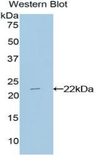CD3E Antibody - Western blot of recombinant CD3E.  This image was taken for the unconjugated form of this product. Other forms have not been tested.