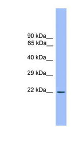 CD3E Antibody - CD3E antibody Western blot of Fetal Brain lysate. This image was taken for the unconjugated form of this product. Other forms have not been tested.