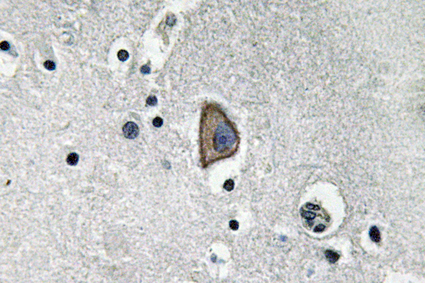 CD3E Antibody - IHC of CD3- (D71) pAb in paraffin-embedded human brain tissue.