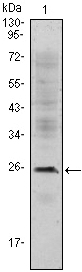CD3E Antibody - Western blot using CD3E mouse monoclonal antibody against Jurkat (1) cell lysate.