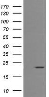 CD3E Antibody - HEK293T cells were transfected with the pCMV6-ENTRY control (Left lane) or pCMV6-ENTRY CD3E (Right lane) cDNA for 48 hrs and lysed. Equivalent amounts of cell lysates (5 ug per lane) were separated by SDS-PAGE and immunoblotted with anti-CD3E.